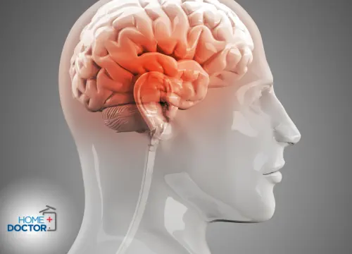 Bóle głowy w skroniach – przyczyny i leczenie 6