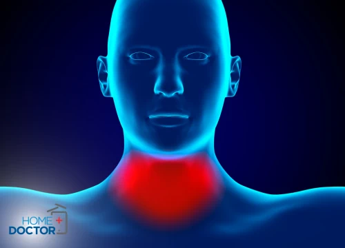 Grzybicze zapalenie gardła – objawy, przyczyny, leczenie 6